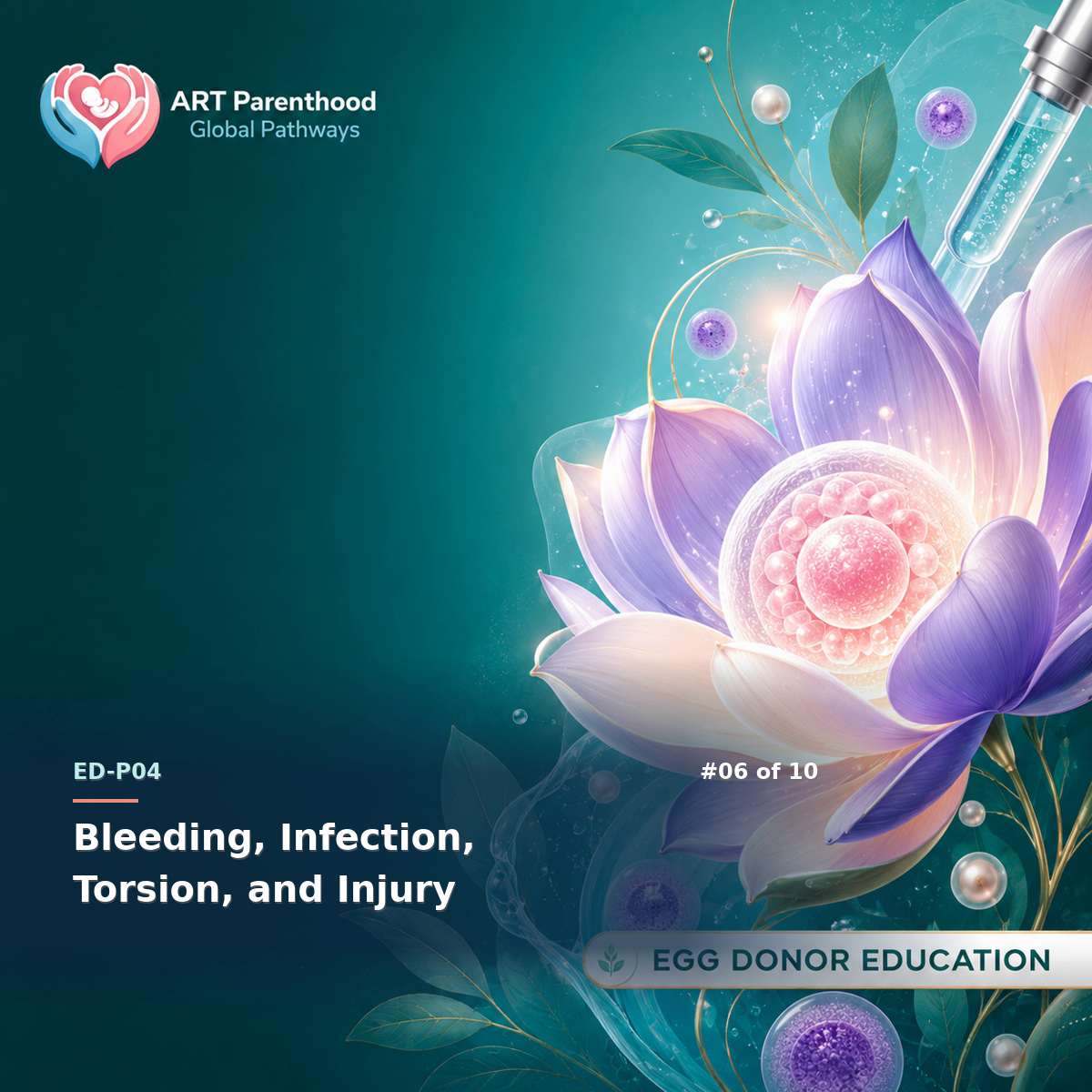 Egg Donors education card for ED-LP04-06: Bleeding, Infection, Torsion, and Injury.